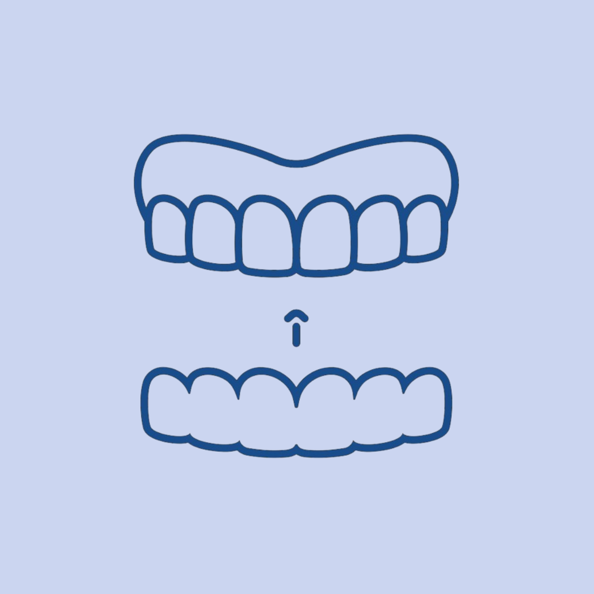 Clear Aligners